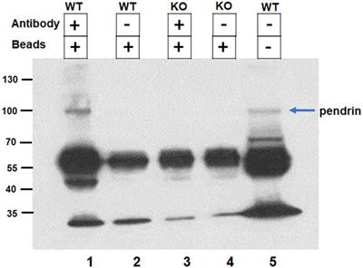 Identification of IQGAP1 as a SLC26A4 (Pendrin)-Binding Protein in the Kidney